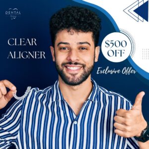 $500 Off Aligner Services