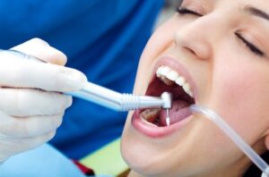 Tooth Extraction In Spring Texas