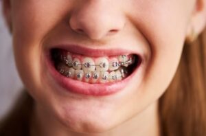 Dental Care In Spring