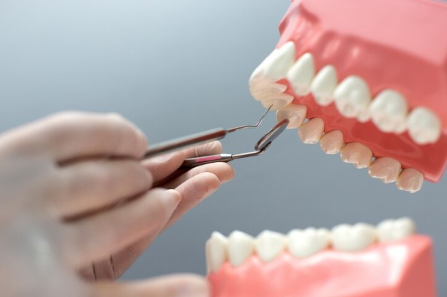 Dental Implants Near Tx 77379