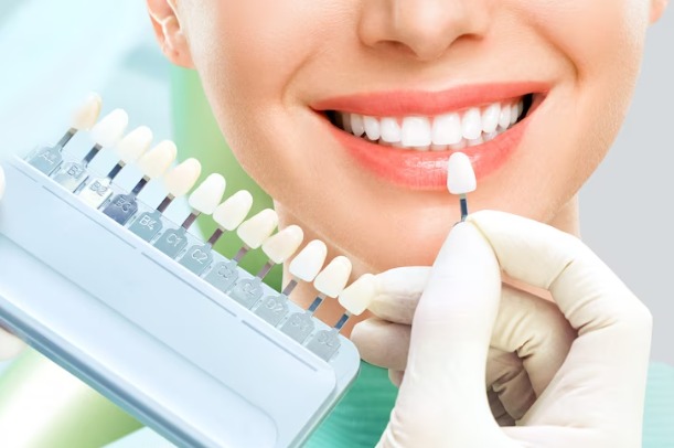 Teeth Whitening In Spring TX 77379