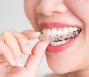 Best dentist for Invisalign in Spring